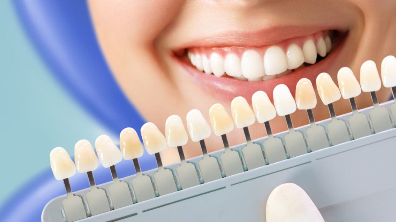 Take Your Whitening Lines to the Next Level with Customized UV Kits & Gels